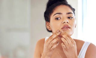 הגיע הזמן לנפץ כמה מיתוסים על אקנה